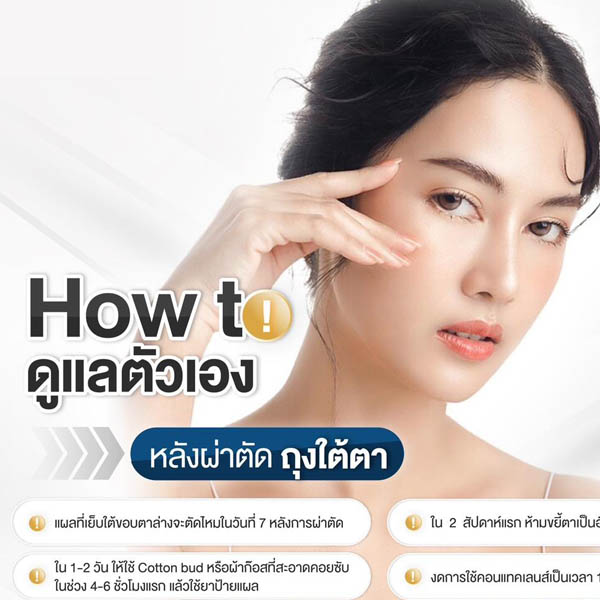 How to ดูแลตัวเองหลังตัดถุงใต้ตา